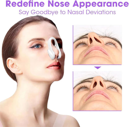 NOSELIFT Nose Sculpting Device